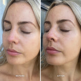 Alpha-H 維他命 E 精華 10ml/25ml