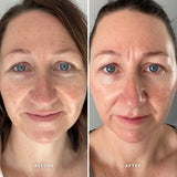 Alpha-H 維他命 E 精華 10ml/25ml