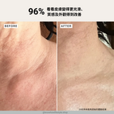 Alpha-H 多元維他命亮白身體補濕精華 150mL