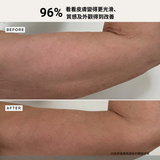 Alpha-H 多元維他命亮白身體補濕精華 150mL