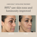 Alpha-H 黃金精華液 30ml/100ml