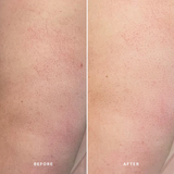 Alpha-H 視黃醇緊緻亮膚身體護理霜  120mL