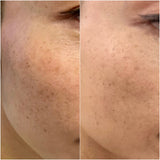 DermaSign 傳明酸淡斑抗炎精華 30ml