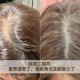 Caditar 防脫髮精華液 100ml