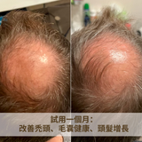 Caditar 防脫髮精華液 100ml