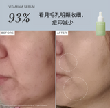 Alpha-H Vitamin A Serum 25ml