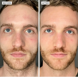 Alpha-H Vitamin B Serum 25ml