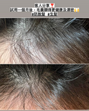 Caditar Anti-Hair Loss Serum 100ml
