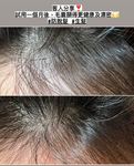 Caditar Anti-Hair Loss Set