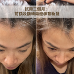 Caditar Anti-Hair Loss Shampoo 150ml